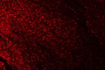 Anti-RPRD1B Antibody