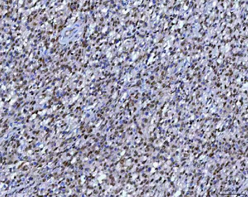 Anti-RPRD1B Antibody