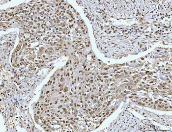 Anti-RPRD1B Antibody