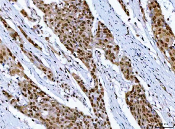 Anti-RPRD1B Antibody