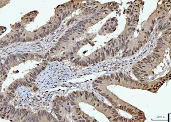 Anti-RPRD1B Antibody