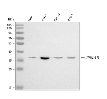 Anti-RPRD1B Antibody