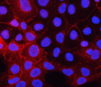 PDGFRA Rabbit Polyclonal Antibody