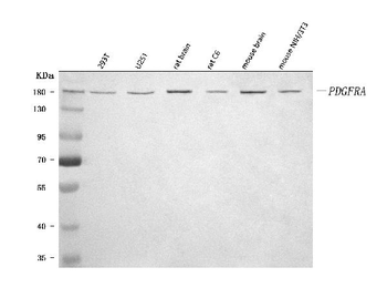 Anti-PDGFRA Antibody