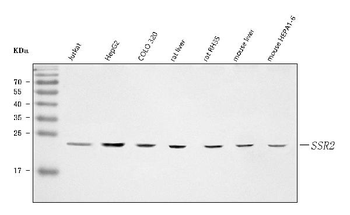 Anti-TRAPB/SSR2 Antibody