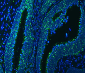 Anti-SSBP1 Antibody