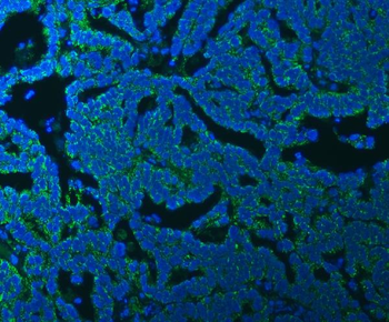 Anti-SSBP1 Antibody