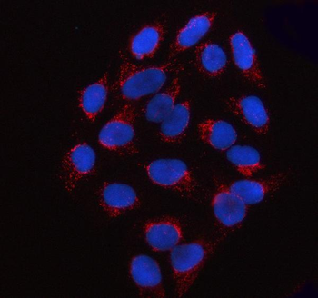 Anti-SSBP1 Antibody