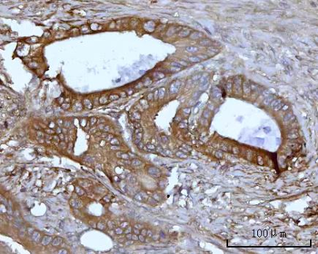 Anti-SSBP1 Antibody