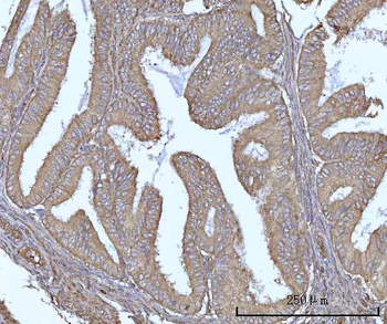 Anti-SSBP1 Antibody