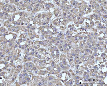 Anti-SSBP1 Antibody