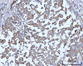 Anti-SSBP1 Antibody