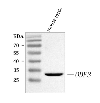 ODF3 Rabbit Polyclonal Antibody