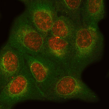 Anti-ONECUT1 Antibody