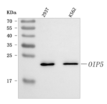 Anti-OIP5 Antibody