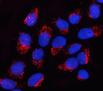 Anti-OGDHL Antibody