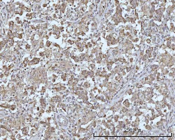 Anti-ODF2L Antibody