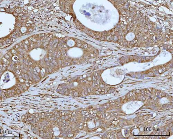 Anti-OCRL Antibody
