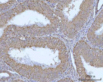 Anti-OCRL Antibody
