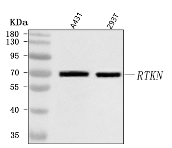 Anti-RTKN Antibody