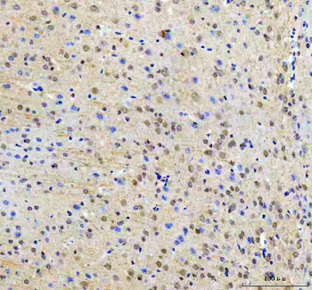 Anti-RTF1 Antibody