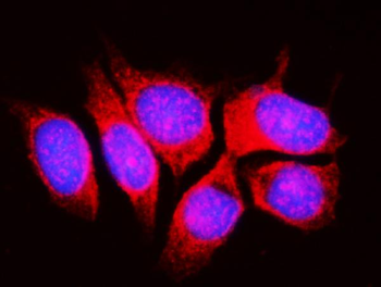 Anti-RPL11 Antibody