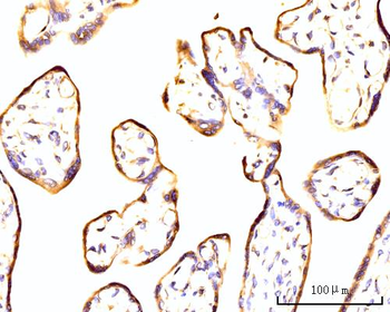 Anti-RPL11 Antibody