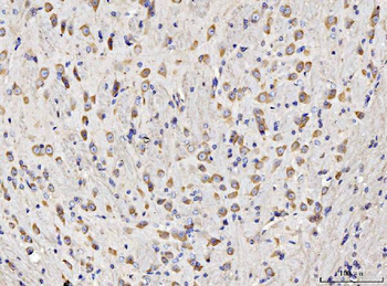 Anti-RPL11 Antibody