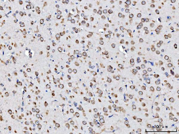 Anti-RPL11 Antibody