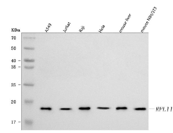 Anti-RPL11 Antibody
