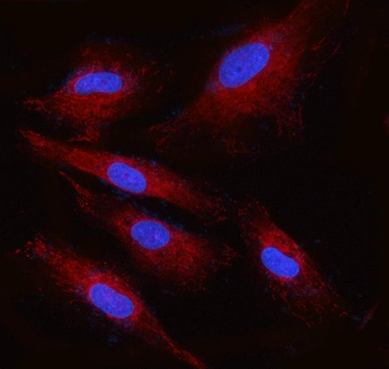 Anti-RPN2 Antibody