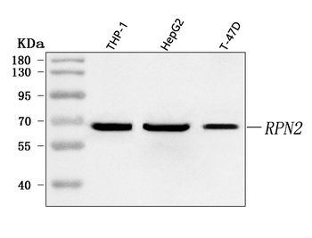 Anti-RPN2 Antibody