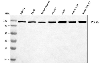 Anti-ROCK1 Antibody