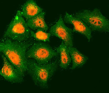 Anti-TMOD2 Antibody