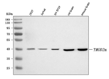 Anti-TMOD2 Antibody