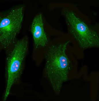 Anti-RRP1 Antibody
