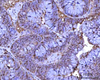 Anti-RRP1 Antibody