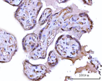 Anti-RRP1 Antibody