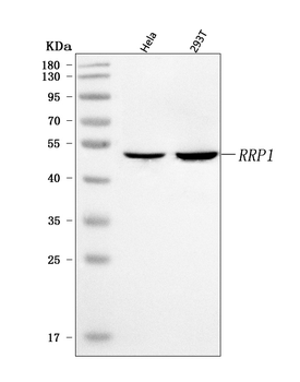 Anti-RRP1 Antibody