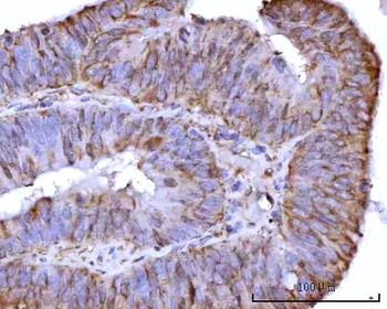 Anti-RPS25 Antibody