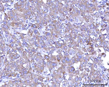 Anti-RPS25 Antibody
