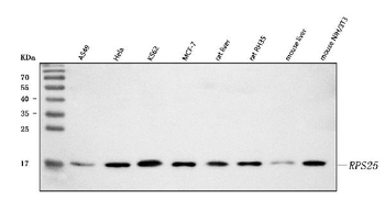 Anti-RPS25 Antibody