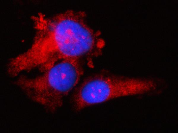 Anti-RPS17 Antibody