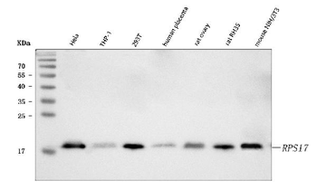 Anti-RPS17 Antibody