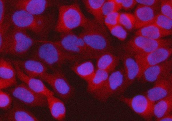 Anti-RPS15A Antibody