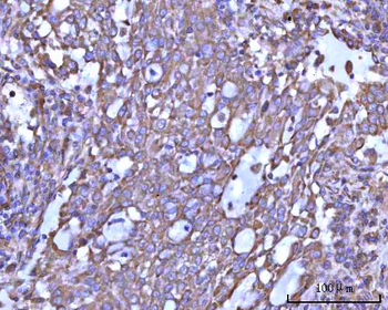 Anti-RPS14 Antibody