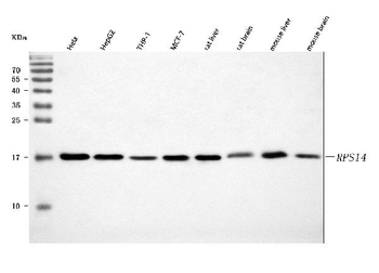 Anti-RPS14 Antibody