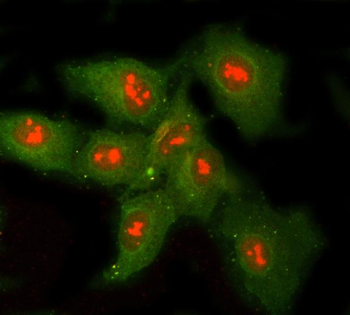 Anti-RNASEH1 Antibody