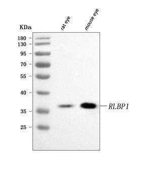 Anti-RLBP1 Antibody