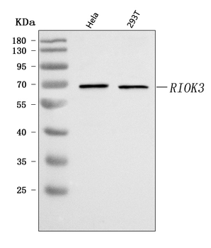 Anti-RIOK3 Antibody